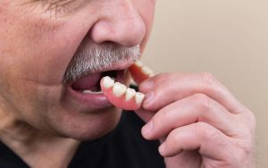 Partial dentures being held by hand, showing natural-looking teeth and gum fit in Toronto